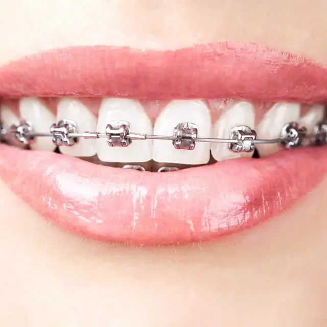 Orthodontics Scarborough Dentist Near Me
